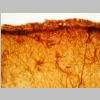 Astroglia GFAP 02.jpg